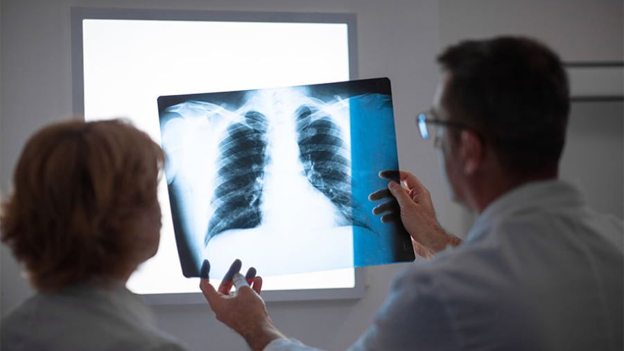 What Are the Body Symptoms of Lung Cancer